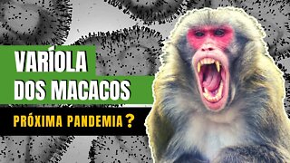 VARÍOLA DOS MACACOS - MONKEYPOX | TUDO O QUE VOCÊ PRECISA SABER | SINTOMAS, TRANSMISSÃO, TRATAMENTO