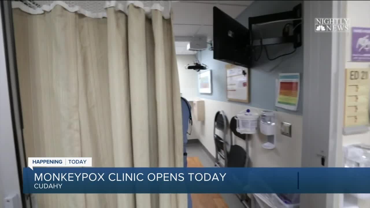 Monkeypox clinic opens today in Cudahy