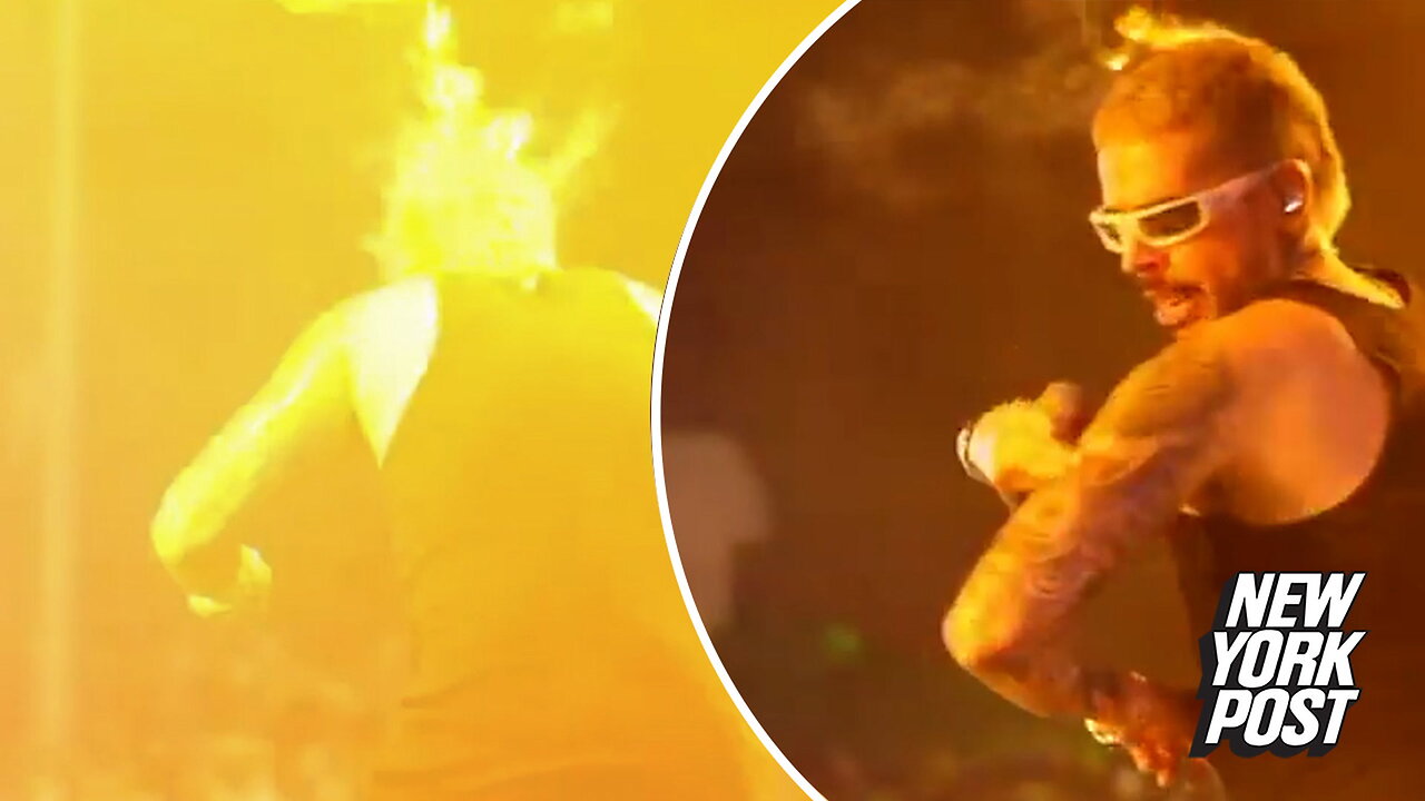 Fiery moment singer Reykon's hair goes up in flames