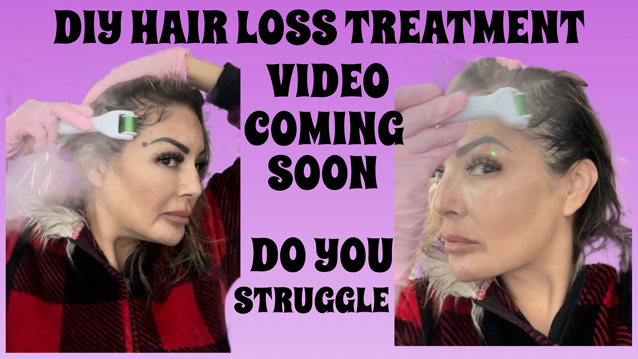 DIY Hair Loss Treatment Video Coming Soon