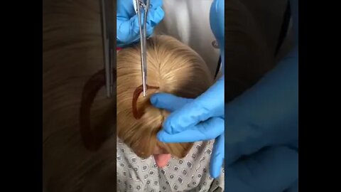 He pulled it from her scalp!…