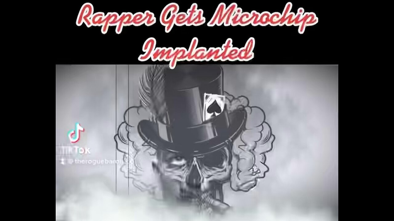 Rapper Gets Microchip Implant