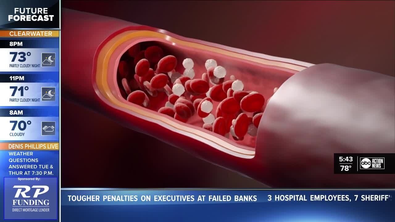 Heart disease: How to protect yourself against the top killer in the US