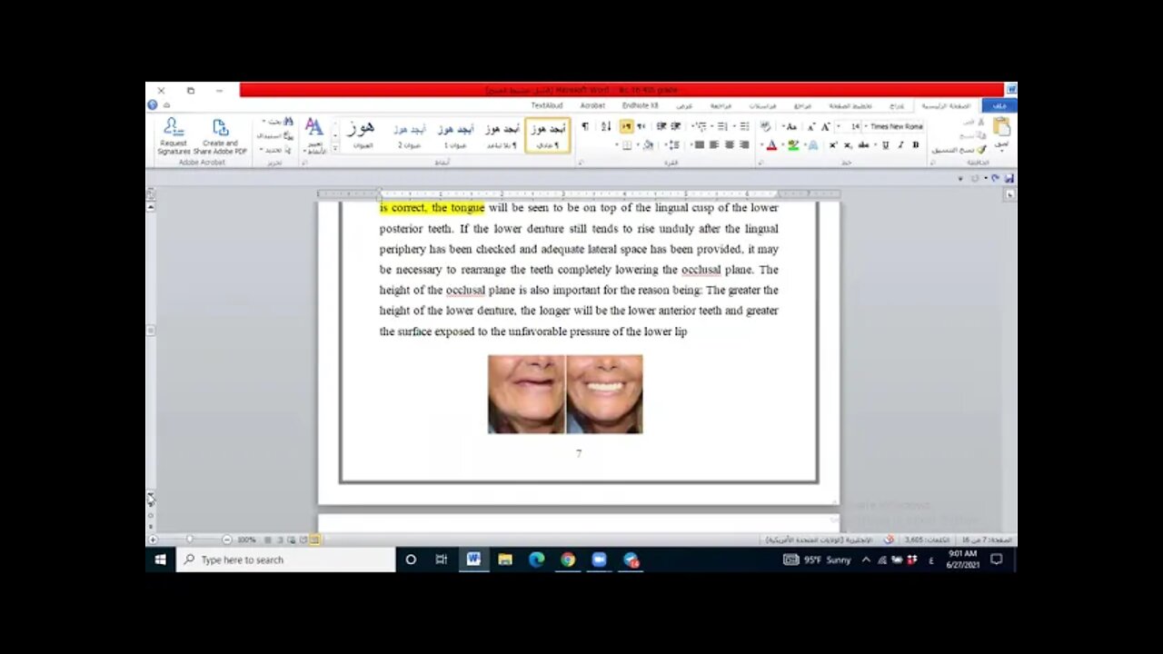 Prosthodontics L16 (Try-In appointment of complete denture)