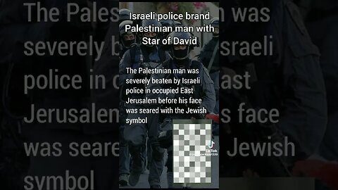 #Man Severely #Beaten & #Branded With Star Of David On His #Face. #Police