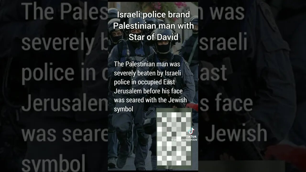 #Man Severely #Beaten & #Branded With Star Of David On His #Face. #Police