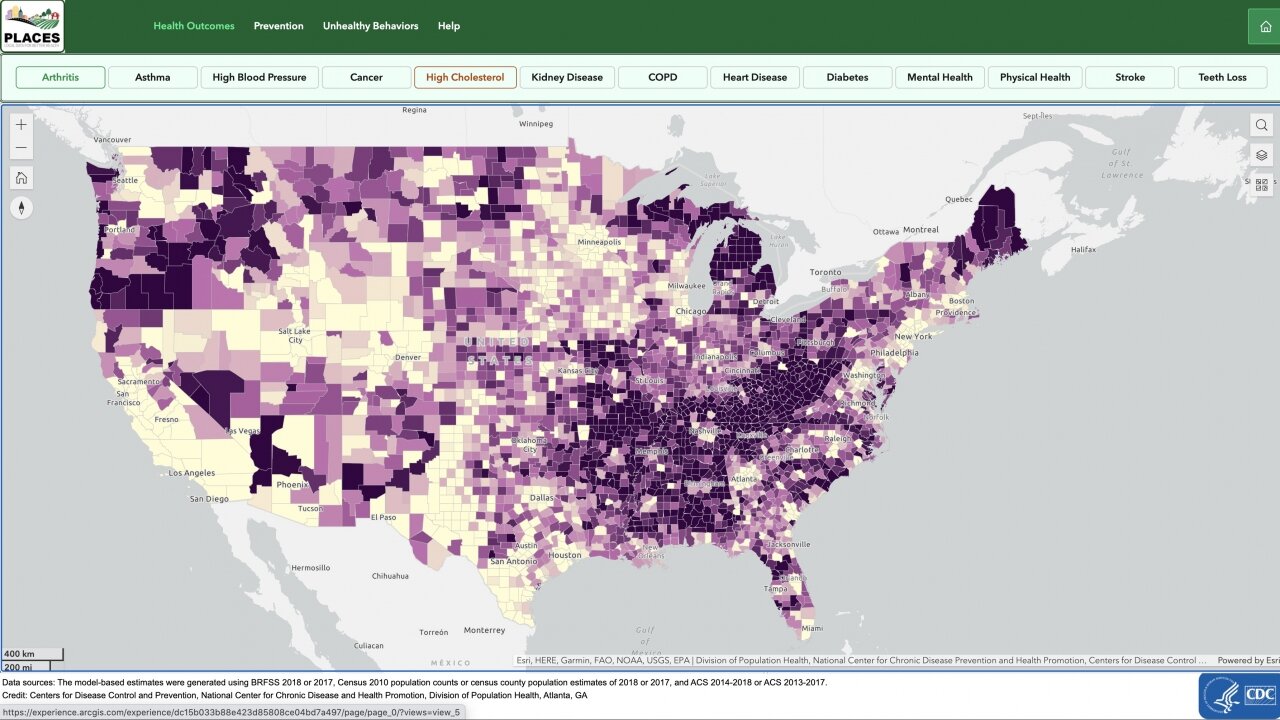 CDC Tool Provides 'Whole New View' of Health of Communities