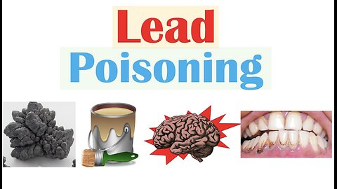 Lead Poisoning (Lead Toxicity) | Sources, Pathophysiology, Signs & Symptoms, Diagnosis, Treatment