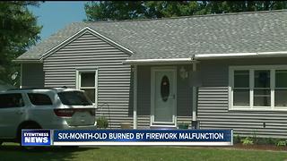 Six-month-old burned by fireworks at home