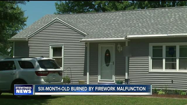 Six-month-old burned by fireworks at home