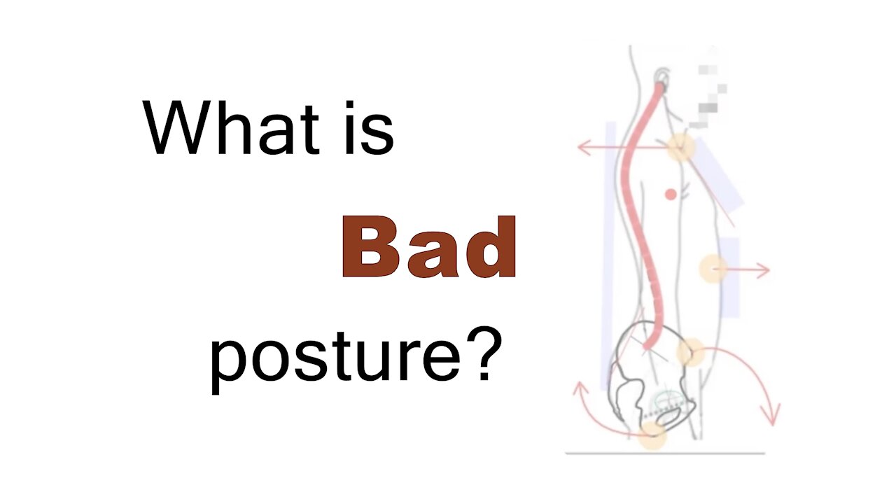 What is Bad Posture? (And why does it matter?)