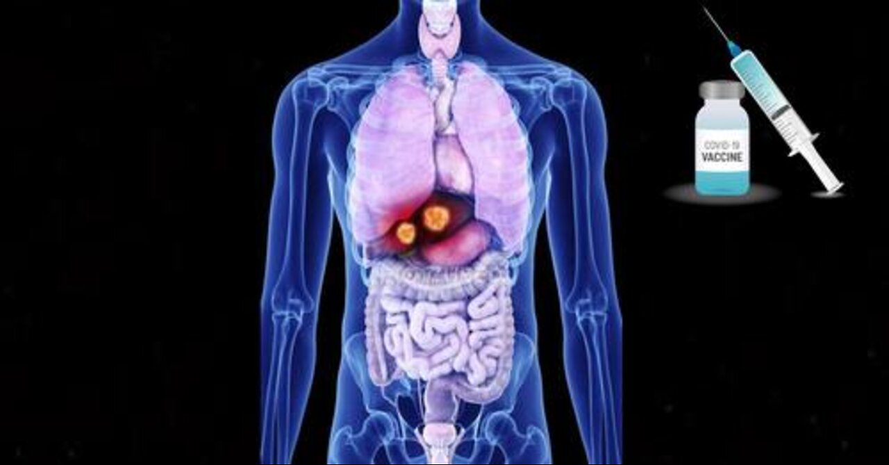 CDC REMOVES 150K DEATHS FROM VAERS SYSTEM - VACCINE GENOCIDE