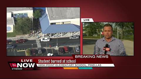 Clearwater student burned in school fire, airlifted to hospital