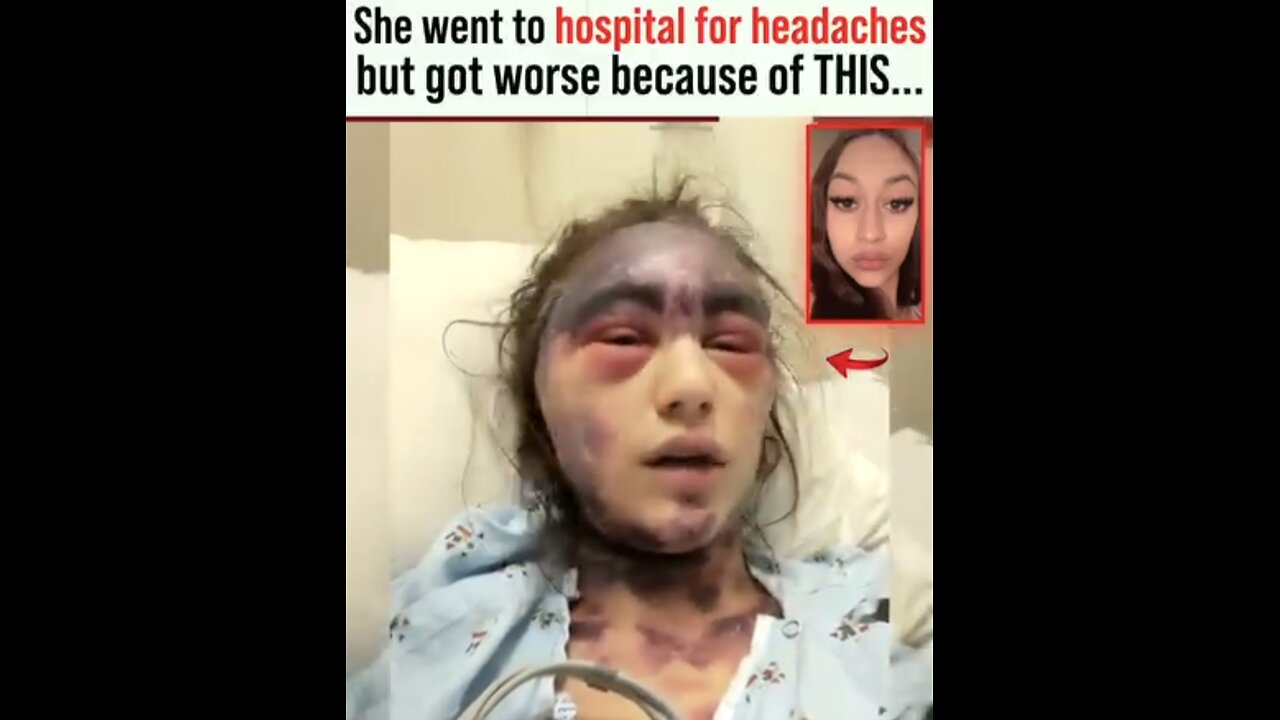 She went to hospital for headaches but got worse because of THIS.