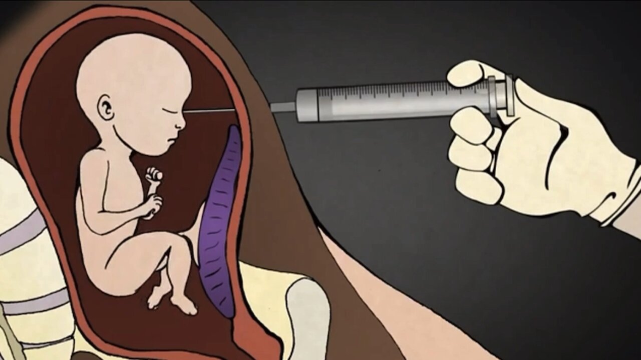 What The Abortion Industry Doesn't Want You To Know Or See