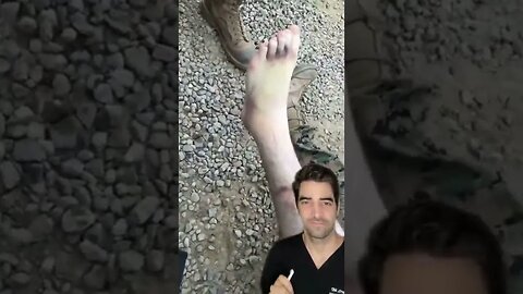 Military Foot Injury