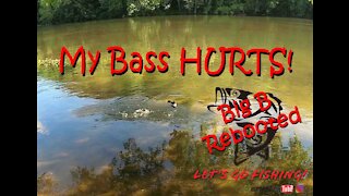 My Bass Hurts