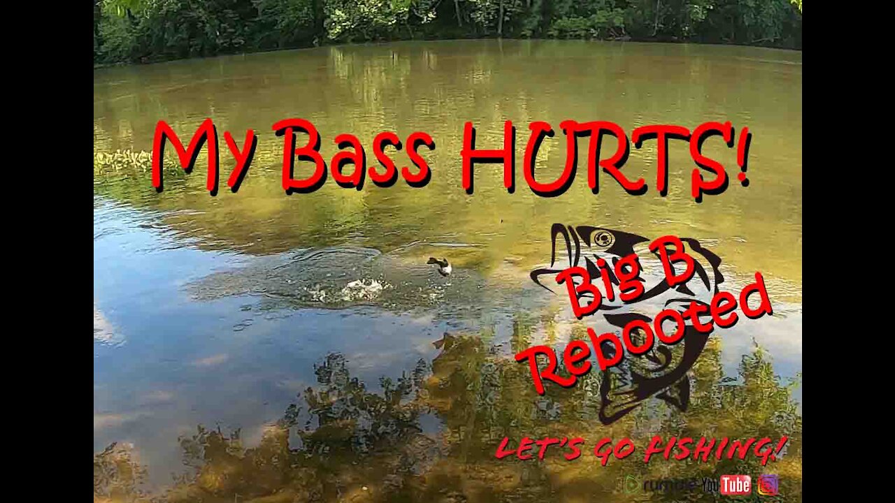 My Bass Hurts