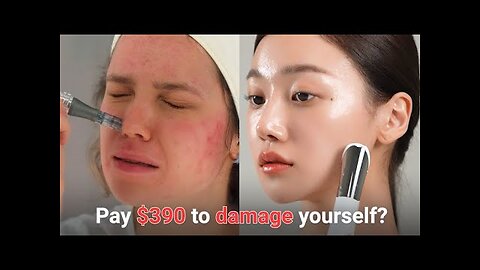 [MEDICUBE] Do you still pay $390 to damage yourself?