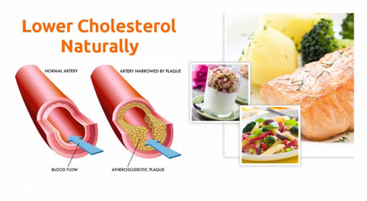 Cholesterol - Use Foods To Lower LDL Cholesterol