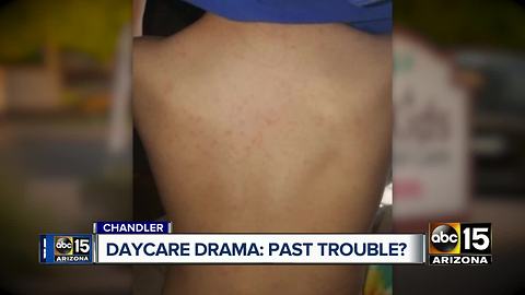 Woman says daycare under fire has history of problems