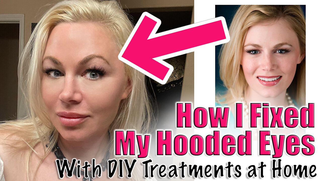 How I Fixed my Hooded Eye Lids with DIY Treatments at Home | Code Jessica10 saves you Money