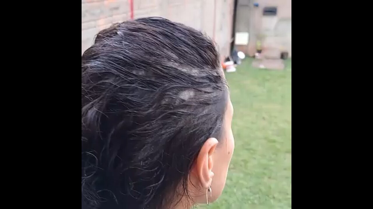 Hair growth