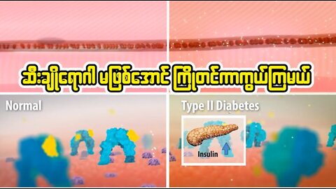 ဆီးချို မဖြစ်အောင် ကြိုတင်ကာကွယ်ကြရအောင်