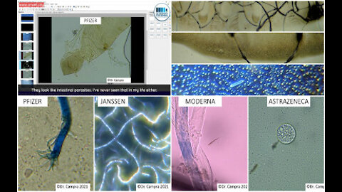 Observations of Possible Microbiota in COVID mRNA Vaccines by Dr. Pablo Campra Madrid