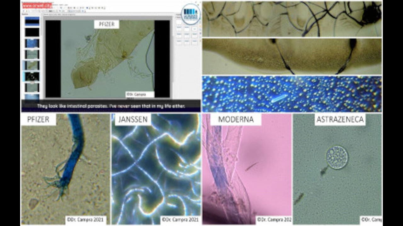 Observations of Possible Microbiota in COVID mRNA Vaccines by Dr. Pablo Campra Madrid