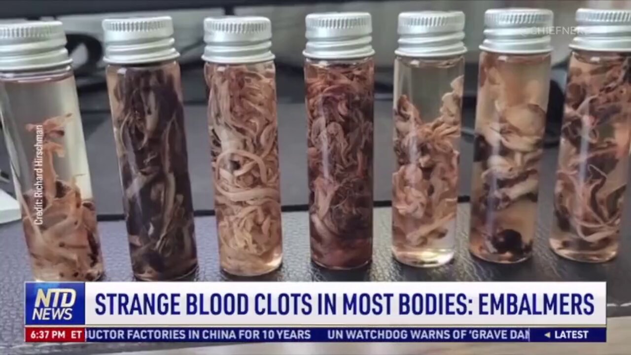 Mysterious Fibrous Clots