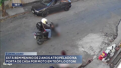 É um milagre!: Está bem menino de 2 anos atropelado na porta de casa por moto em Teófilo Otoni.