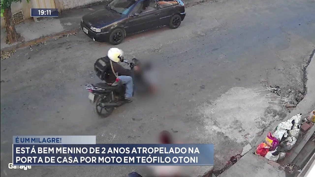 É um milagre!: Está bem menino de 2 anos atropelado na porta de casa por moto em Teófilo Otoni.