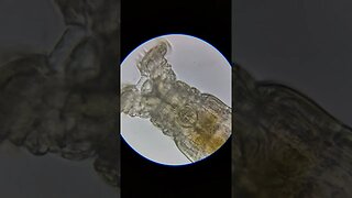 Rotifer 1000x magnification #microscope #microbiology #rotifer #shorts