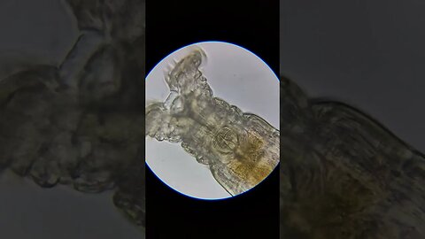 Rotifer 1000x magnification #microscope #microbiology #rotifer #shorts