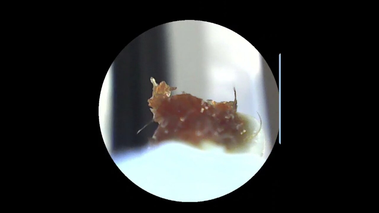 Cleaning out my husband's earwax 🤮 - BeBird Endoscope