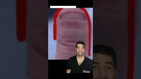 Oddly shaped nails