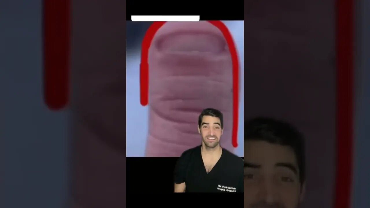 Oddly shaped nails