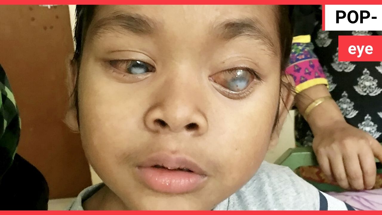 Blind boy whose eye popped out can see again - thanks to Doctor