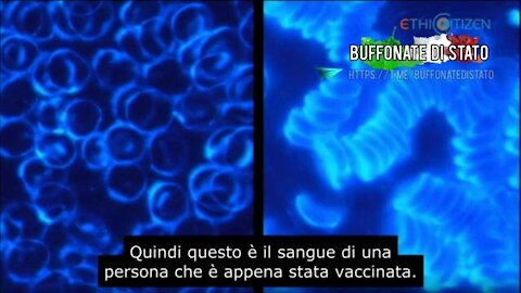 L'aspetto del sangue prima e dopo il vaccino