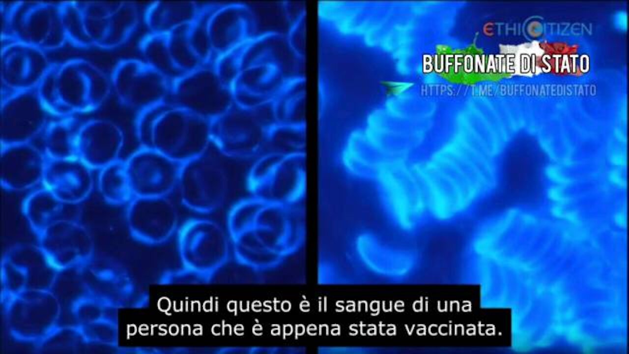 L'aspetto del sangue prima e dopo il vaccino