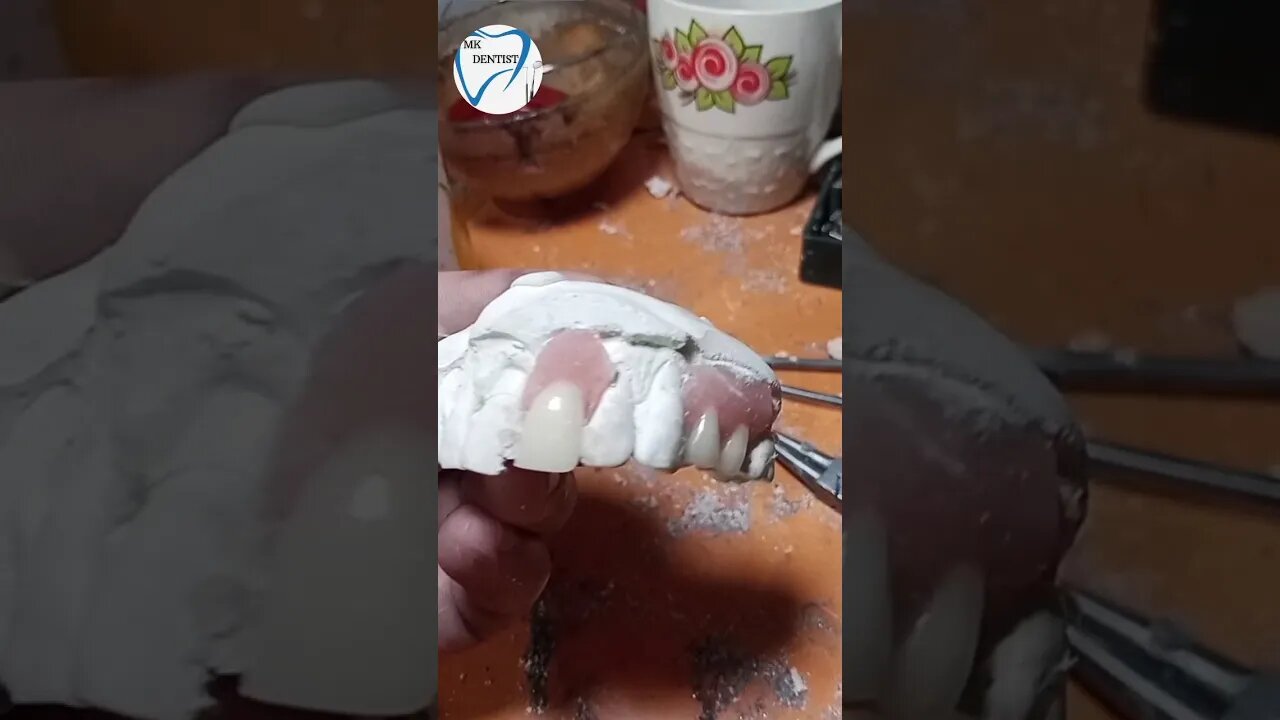 Flexi partial teeth #dental #viral #shorts