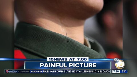 Pin facing neck used to help soldiers keep their posture?