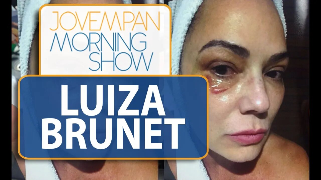 Luiza Brunet aparece com olho roxo em foto após agressão | Morning Show