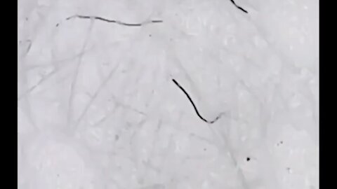 Morgellons seen on masks under close examination!