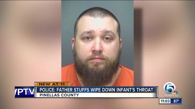 Florida father charged with stuffing wipes in baby's throat