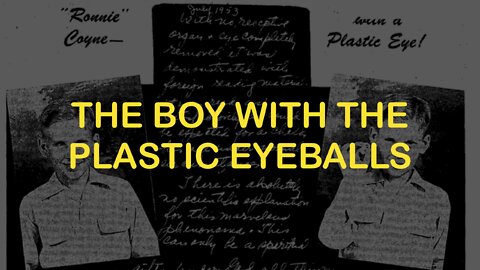 The Boy With the Plastic Eyeballs