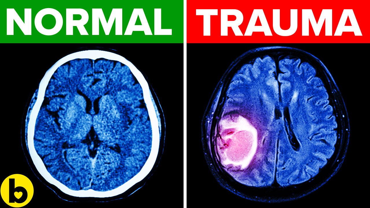 Early Childhood Experiences May Lead To Irreversible Changes In The Brain: STUDY