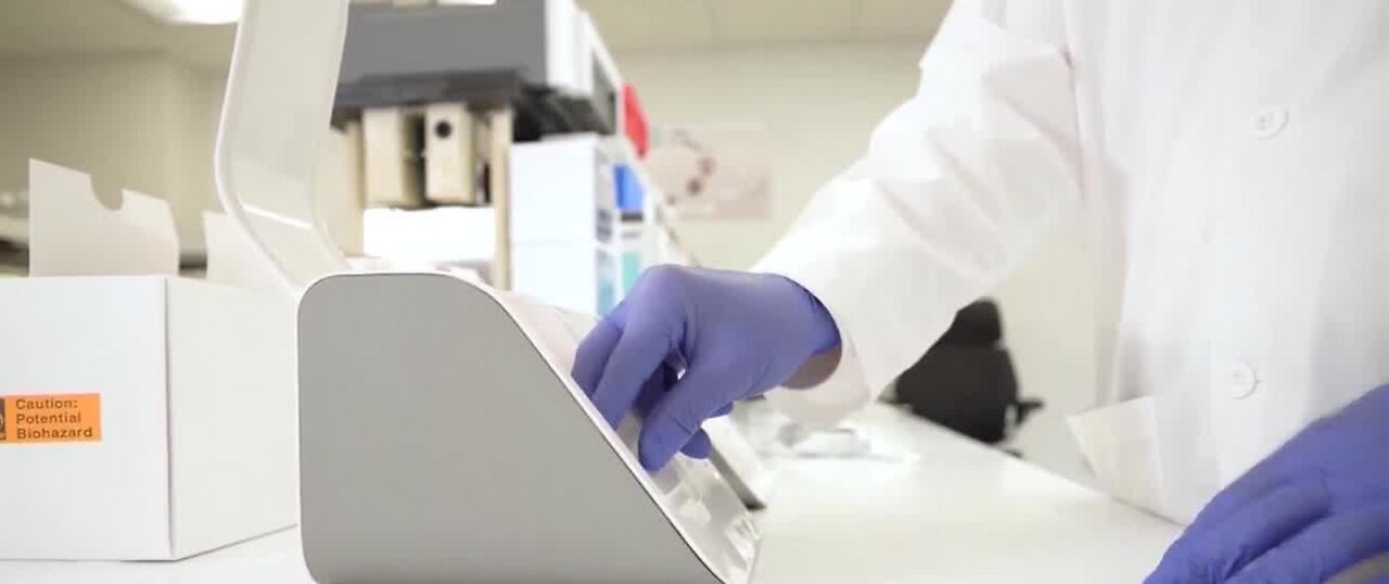 Test could detect if you had COVID-19 & recovered