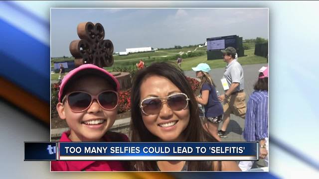 Too many selfies could lead to 'selfitis'